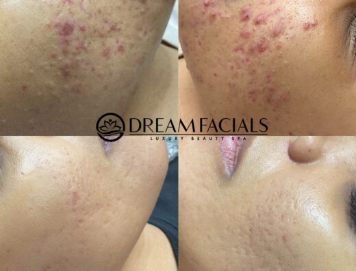 Dream Facials