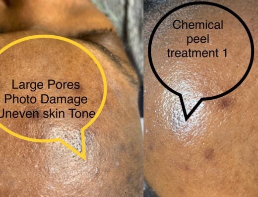Facials By Vanessa CT